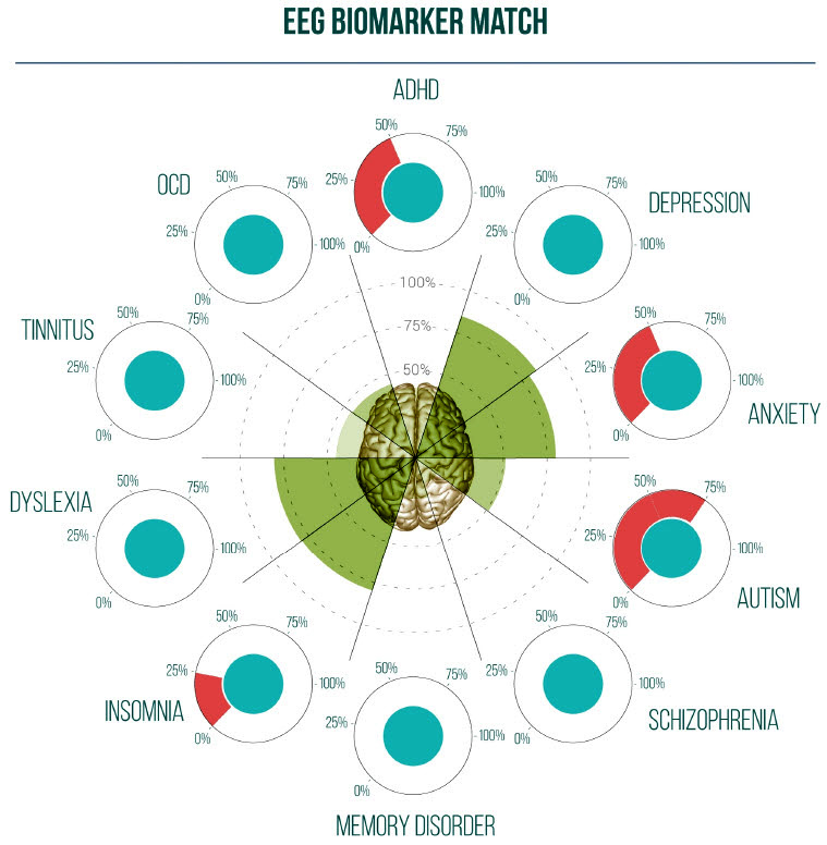 EEG biomarker match